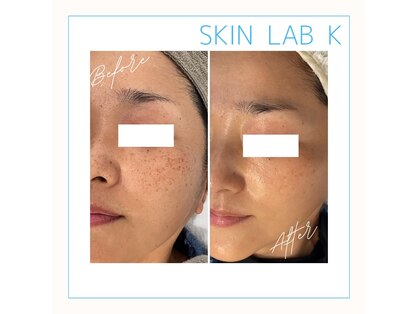スキン ラボ ケー(Skin lab K)の写真