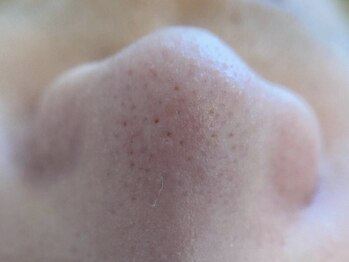 リセットプラス(Reset+)/