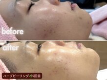 シルク(Cilk)の雰囲気（お客様一人ひとりのお悩みに寄り添い、美しいお肌へと導きます。）