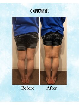 コア カイロプラクティック 錦糸町/ビフォーアフター 錦糸町/亀戸