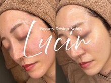 ルシール 仙台店(lucir)/<ララピール> Before/After
