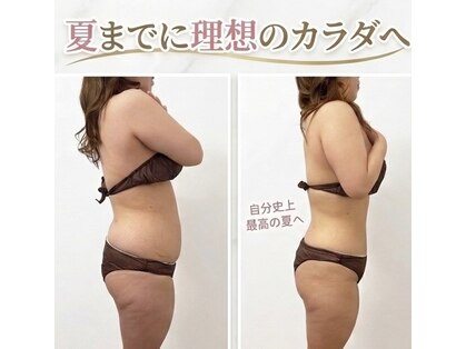 ステラフィールド(stella field)の写真