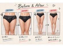 ヨサパーク ゴールデンツリー 浦安本店(YOSA PARK GordenTree)の雰囲気（サイズダウン・全身痩せ・体脂肪削減お任せください☆リンパ流し）