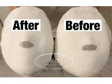 美極 トータルビューティー(美極 TOTAL BEAUTY)/恵比寿/小顔コルギ/エステ/