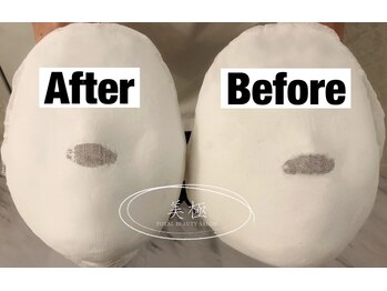 美極 トータルビューティー(美極 TOTAL BEAUTY)/恵比寿/小顔コルギ/エステ/