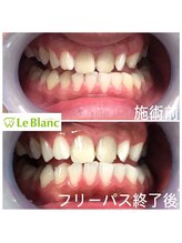 ルブラン 奈良店(Le Blanc)/第一印象は3秒で決まる！！