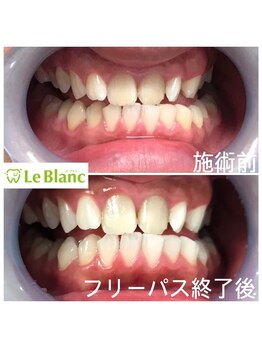 ルブラン 奈良店(Le Blanc)/第一印象は3秒で決まる！！