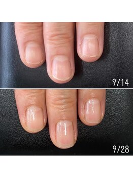 ネイルズ アヴァンティ(Nails Avanti)/「深爪伸ばし」自爪育成お試し