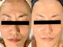 クク(ququ)/元から根本改善