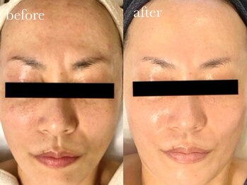 クク(ququ)/元から根本改善