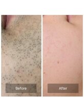 ラッシュ(RUSH)/初回→13回目