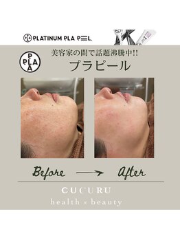ククルヘルスビューティー(CUCURU health×beauty)/プラピールで水光肌