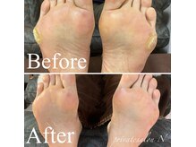 ガチガチカサカサ角質でお困りの方もお任せください☆