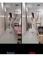 ピラティスエルエー(pilates LA)/たった1回のビフォーアフター