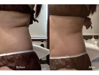 アネル うるま店(anel)/レモンボトル2回/28日間の結果！