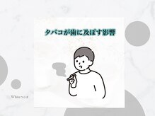ホワイト つくば店(WHITE)/タバコと歯の関係