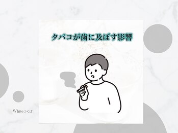 ホワイト つくば店(WHITE)/タバコと歯の関係