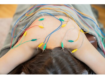 あかり鍼灸接骨院/鍼灸