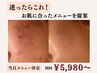 【当日ご相談】カウンセリング＆診断＆施術 ￥5,980～