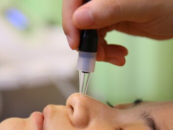 アトリエ ホミィの写真/夏に向けて毛穴のお掃除を！肌荒れにも効果的です！お気軽にお越しください♪