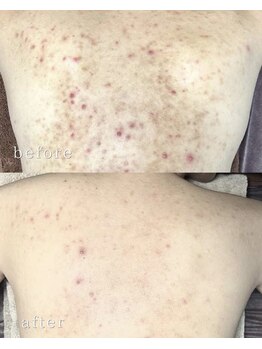 リルビー(Lilby)の写真/自己流では難しい、ボディのお悩みにはプロのケアを。