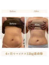 モナ 宝塚店(Mona)/ファスティング×最先端痩身機器