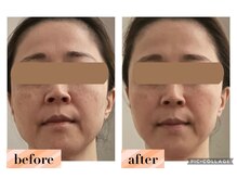 マンダ 田町(Manda)/オールハンドでリンパを流します