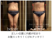 ライフチャージ(Life Charge)/筋膜リリースBefore→After