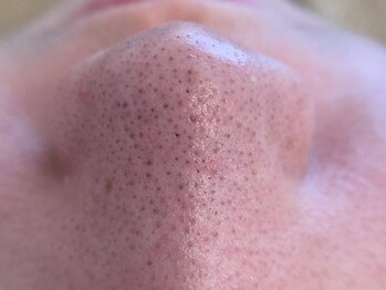 リセットプラス(Reset+)/