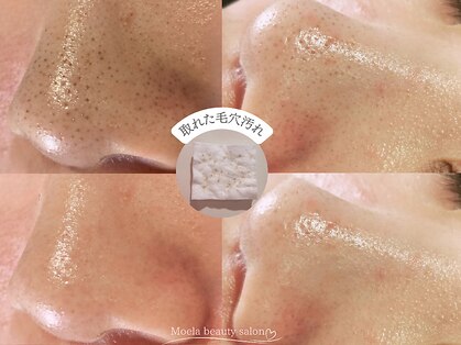 モエラビューティーサロン(Moela beauty salon)の写真