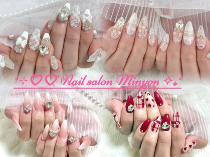 ミニョン(Minyon)の写真