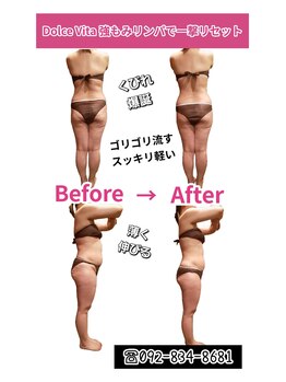 ドルチェヴィータ(DOLCE VITA)/強もみリンパで一撃リセット！