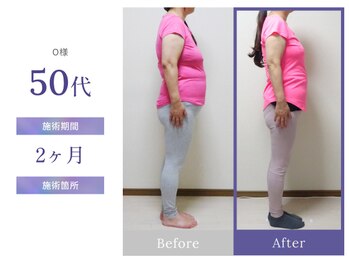 ビップ 赤坂店(Bipp!)/50代・2カ月の変化