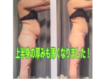 ボディエステティック アクアオーラ 富山店/厚みも薄く！