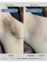 ジールクス 太田店(G LUX)/ワキ