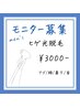 【メンズクーポン】　ヒゲ　光脱毛　1回　3000円 