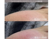 美顔秘密基地 新宮の雰囲気（フェイシャルワックス目の周りよく見るとこんなに産毛あります）