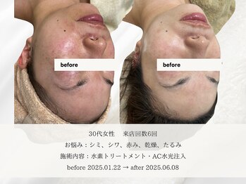 エメ(aimer)/SkinCare《肌管理・エイジング》