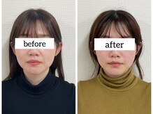 フェリス(Feliz)の雰囲気（小顔/リフトアップ/肌質改善/ほうれい線/むくみなど徹底改善♪）