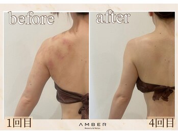 アンバー 恵比寿(AMBER)/駆け込みブライダルの方にも◎