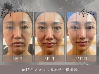 ゴールデンケア(goldencare)/【Vリフト】+7Dコルギ+頭矯正