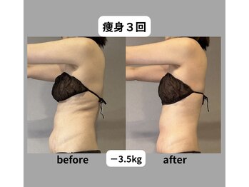 エネイブル(ENable)/