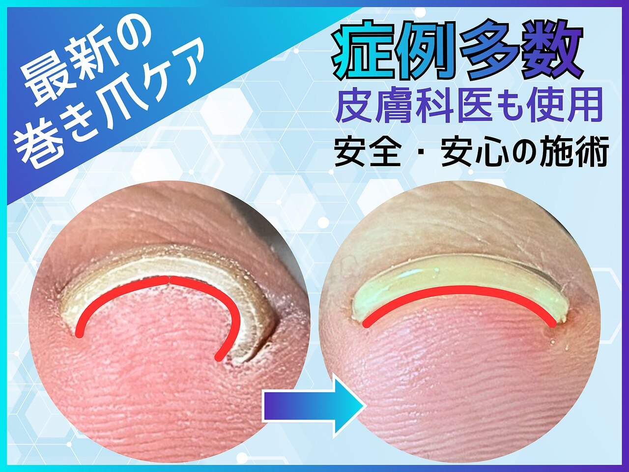 エラック 大阪本店(ERAC)｜ホットペッパービューティー