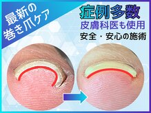 【巻き爪 魚の目 たこ フットケア専門店】ERAC エラック 大阪本店