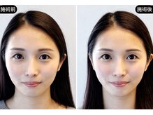 アオヤマ サロン ワイゼット(AOYAMA SALON YZ)