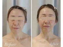 イフ(if...)の雰囲気（骨格バランスを合わせた施術で艶肌リフトアップ/首肩こり改善）