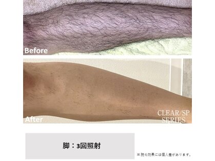 メン脱 三軒茶屋(Men脱)の写真