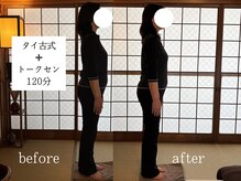 くすの木タイ古式サロン アンド スクール/反り腰のケアリラクゼーション
