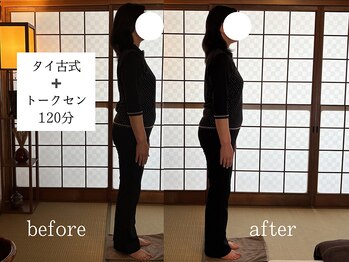 くすの木タイ古式サロン アンド スクール/反り腰のケアリラクゼーション