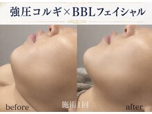 モミン(MOMI.N)の雰囲気(強圧コルギでフェイスラインもリフトアップ◎痛いけど超スッキリ)